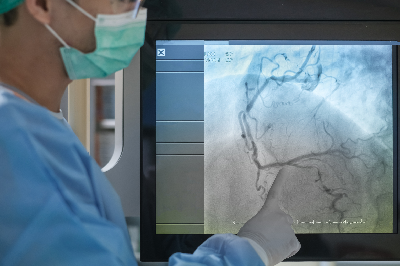 Op Angiogram G&H Cardiovascular - World class cardiovascular care
